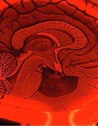 MR tekniğiyle beynimizi görüp acımızı azaltmamız mümkün
