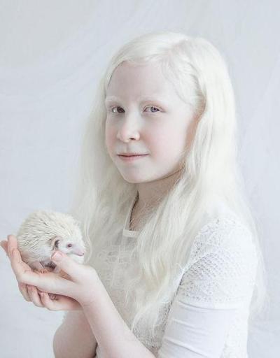 Porselen bebek değil, Albino güzelliği