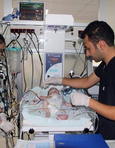 Suriyeli bebeğin kalbinin yarısı çalışmıyor