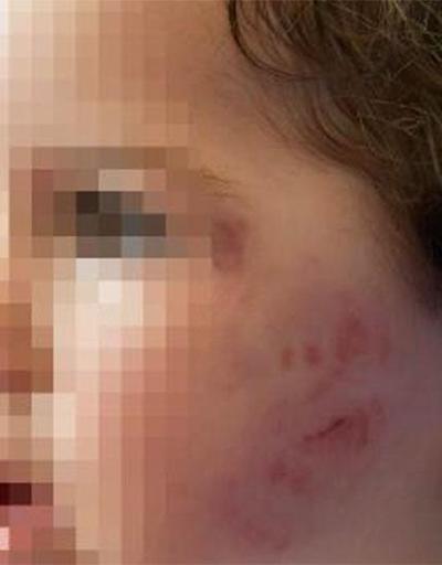 1,5 yaşındaki kız çocuğuna kreşte dayak iddiası
