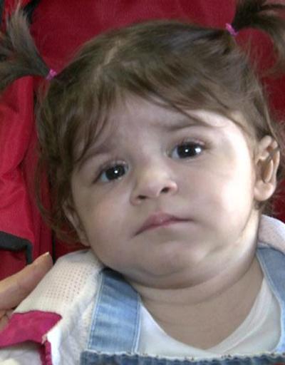 Mucize bebek Bilge: 1 yaşında 3 ameliyat atlattı