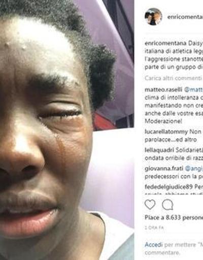Yumurtalı saldırıda Nijerya asıllı İtalyan sporcu gözünden yaralandı