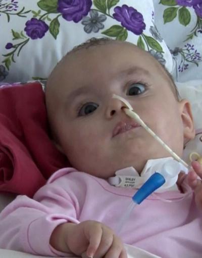 SMA hastası Hafsa bebek yaşamak için yardım bekliyor