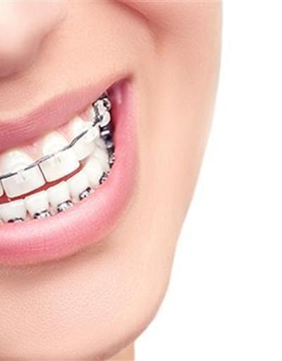 Diş teli olanlarda ağız bakımına dikkat