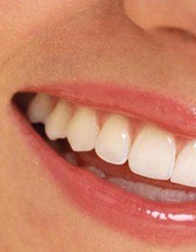 “Diş taşı, diş kaybına neden olabilir”