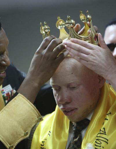 Zimbabwede albino güzellik yarışması Cadı değil güzeliz