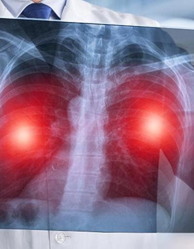Akciğer kanserinin belirtileri nelerdir