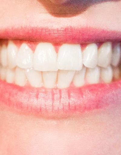 Diş beyazlatıcı tozlar zararlı mı