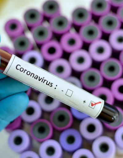 Corona virüsünde son durum ne Koronavirüste ölü sayısı artıyor