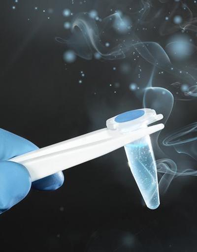 Sperm testi nedir Sperm örneği verilirken nelere dikkat edilmeli