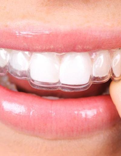 Ortodonti tedavisinde saklı tel nedir