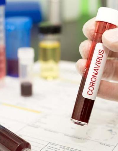 Koronavirüs teşhisi nasıl konulur