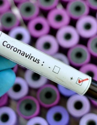 Corona virüsü aşısı bulundu mu İşte Corona aşısında son durum