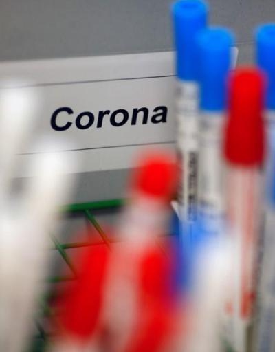 Dikkat Herkesi ilgilendiriyor: Koronavirüs sürecinde sağlık sigortasına 14 gün kuralı
