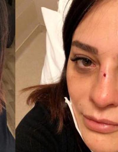 Şarkıcı Reyhan Karacanın burnu kırıldı