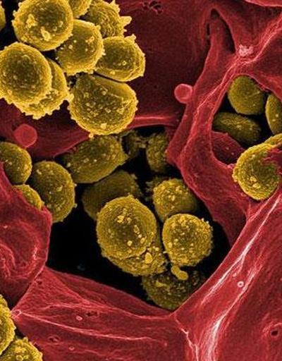 Araştırma: Bakterilerin ölüm çığlığı diğer bakterileri uyarıyor