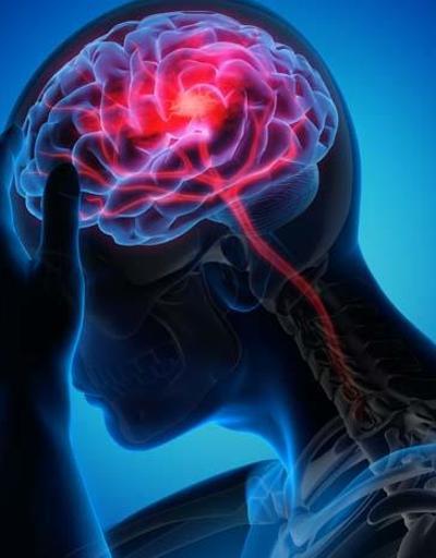 Beyin Cerrahi Nedir Beyin Cerrahi Hangi Hastalıklara Bakar Uzmanı Ve Doktoru Neye Bakar