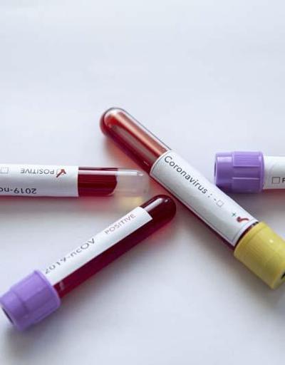 Kan grubu “O” veya negatif olanların koronavirüse yakalanma riski daha az