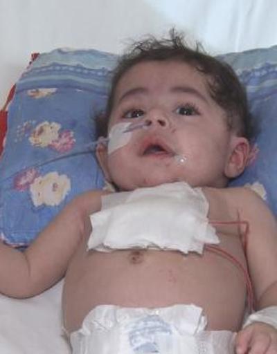 Dünyada 33, Türkiye’de 2nci vaka 5 aylık bebeğin kalbine Türk doktordan zırh