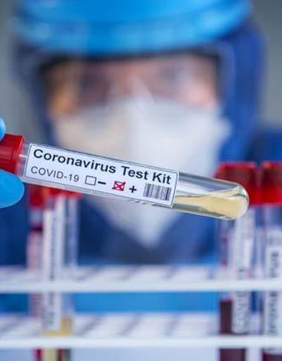Koronavirüs, down sendromlularda 10 kat daha ölümcül