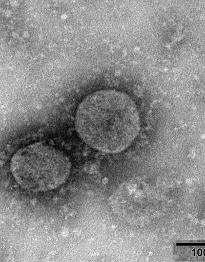 Koronavirüsün kaynağı neresi DSÖ, İtalyayı işaret etti