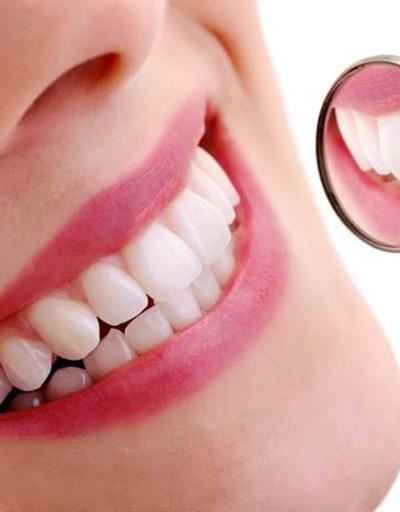 Bilinçsiz yapılırsa dişlerde hasar bırakıyor İşte diş beyazlatma yöntemleri ve etkileri