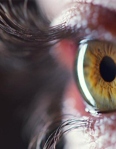 Sarı nokta hastalığı nedir COVID-19 sürecinde sarı nokta hastalığı hafife alınmamalı