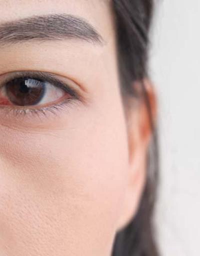 Şeker hastalarında görülüyor Göz içi kanamalarına dikkat
