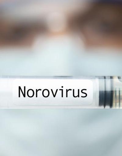 Norovirüs belirtileri nelerdir, nasıl geçer Norovirüs 2021 nasıl bulaşır, özellikleri neler