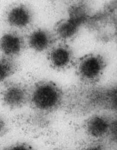 Koronavirüsün delta varyantı Rusyada görüntülendi