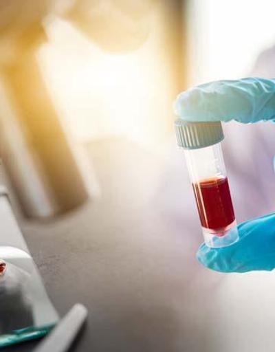 Ezber bozan araştırma: Yeni kan testi 50den fazla kanser türünü tespit edebilir