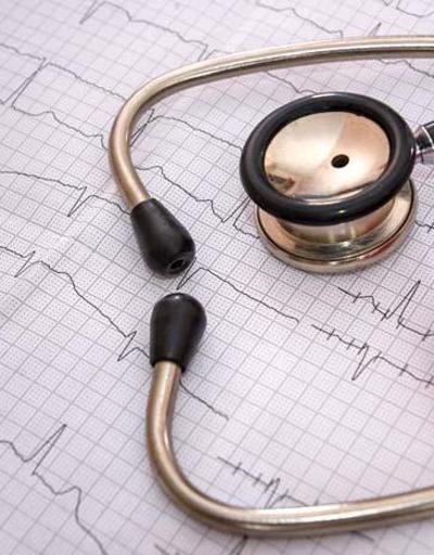 Dikkat Kalp krizinde hayat kurtarıyor Anjiyografi hakkında en çok merak edilen 8 soru