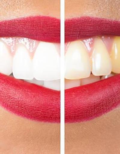 Dişleri beyazlatan doğal temizleyici