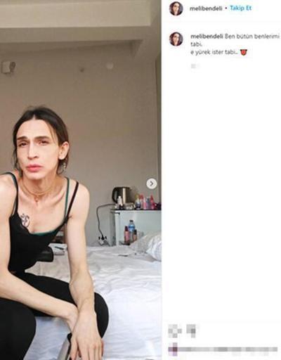 Trans olan Ahmet Melih Yılmazın annesi konuştu