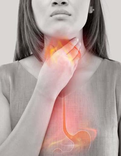 Gastroözofageal reflü hastalığı nedir ve nasıl tedavi edilir