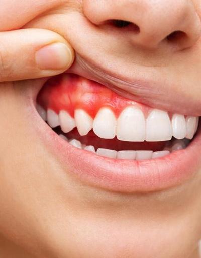 Yanlış yapılan diş ve diş eti işlemleri sağlığımızı da etkiliyor