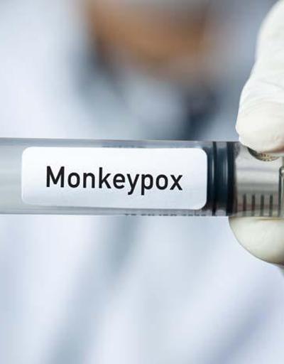 Uzmanı açıkladı: Maymun çiçeği virüsü ölümcül mü Belirtileri neler, kimler risk altında