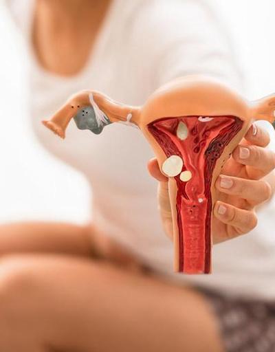 Endometriozis hastalığının belirtileri nelerdir