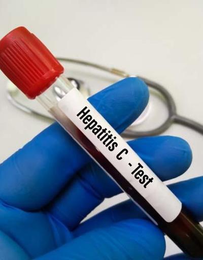 Uzman isimden hepatit uyarısı: Çoğu kişi enfekte olduğunun farkında değil