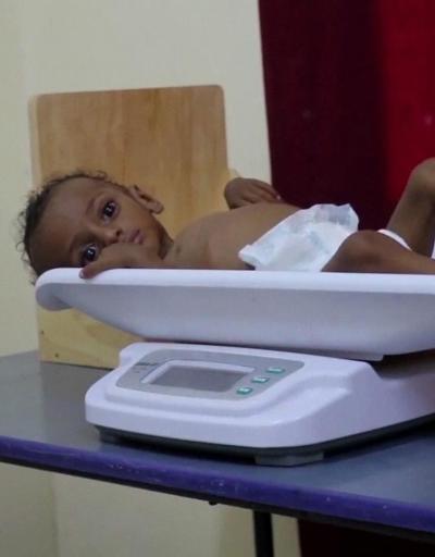 Yemende açlık krizi