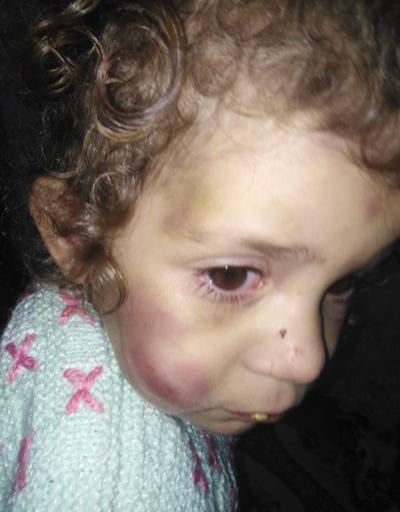 Gaziantep’te kan donduran olay 5 yaşındaki çocuğuna günlerce işkence ederek aç bıraktı