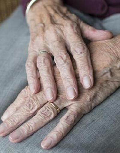 1 saatlik işlemle ellerdeki yaşlılık izlerini silmek mümkün