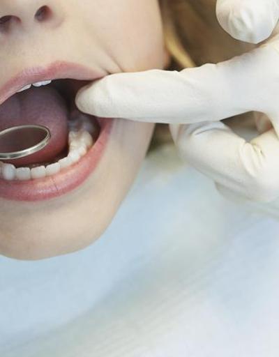 Oruç tutarken diş çektirmek orucu bozar mı Diyanete göre oruçluyken diş tedavisi orucu bozar mı