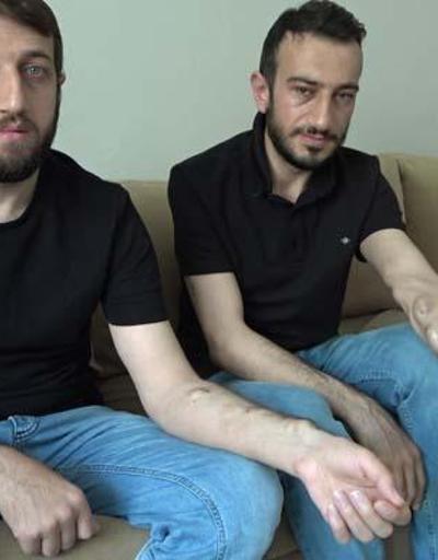 Sultanbeyli’de böbrek hastası iki kardeş yaklaşık 10 yıldır nakil bekliyor