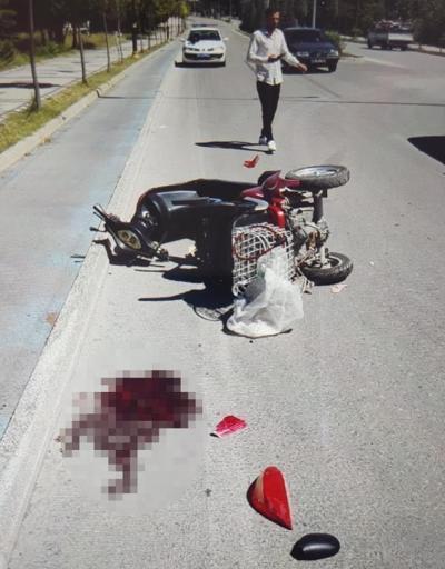 Otomobille elektrikli motosiklet çarpıştı: 1 yaralı