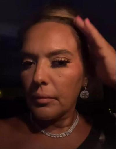 Demet Akalın talihsiz bir kaza geçirdi