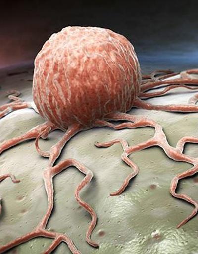 Kanser Çeşitleri Nelerdir En Çok Bilinen Kanser Çeşitleri...
