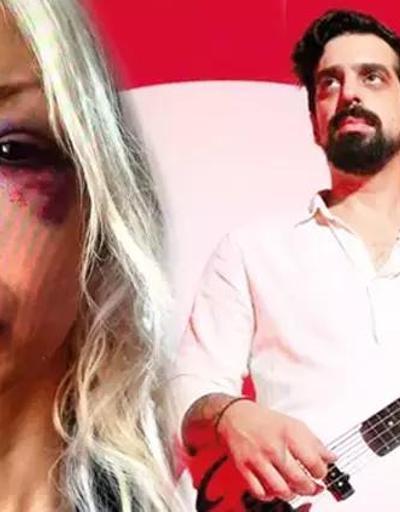 Ünlü müzisyen hakkında şoke eden iddia Can Tunaboylu sevgilisi Aybike Çelike şiddet uyguladı