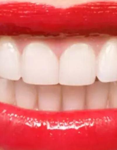 Diş beyazlatma zararlı mı
