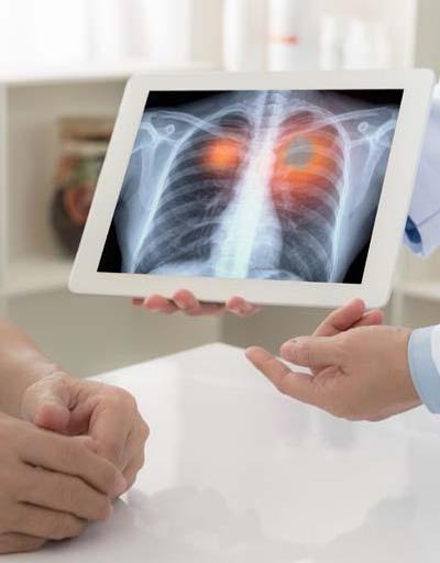 Akciğer kanseri görülme yaşı 30lara düştü